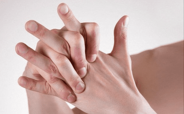 Cứng khớp ngón tay làm giảm sự linh hoạt trong vận động