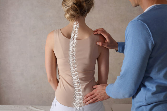 Thoái hóa cột sống thắt lưng có thể dẫn đến các dị tật